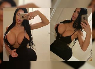 Quebec: Se sometió a 101 cirugías plásticas y murió en el quirófano