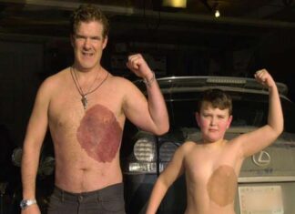 Cánada: Padre se tatua la mancha de nacimiento que acomplejaba a su hijo